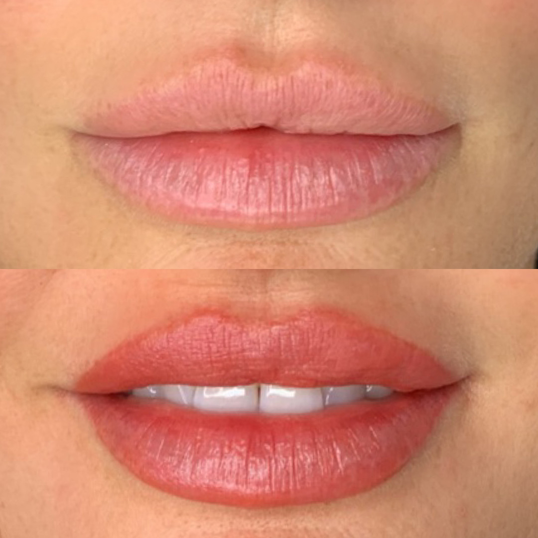 A client before and after receiving lip blush tattoo treatment