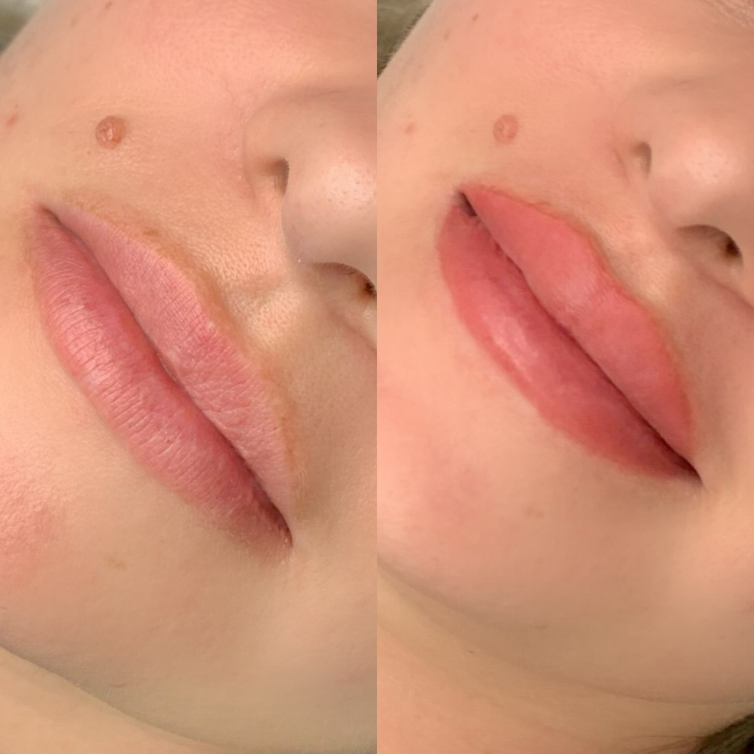 A client before and after receiving lip blush tattoo treatment